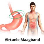 Virtuele Maagband