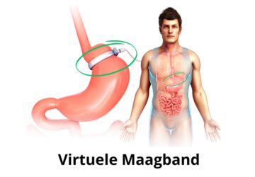 Virtuele Maagband