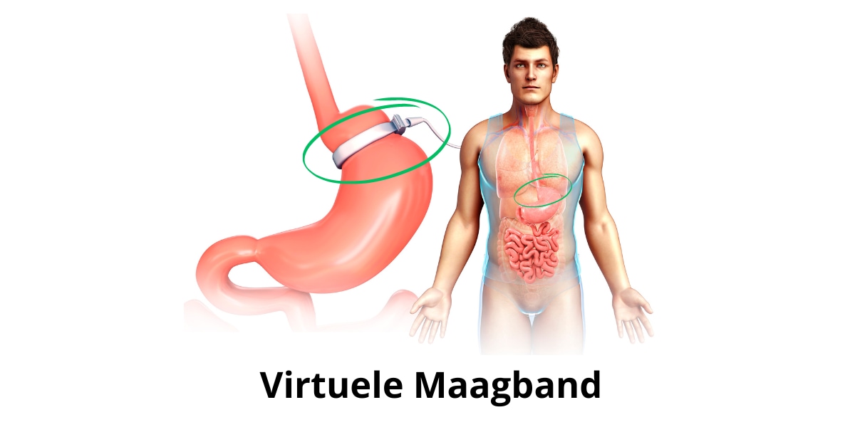 Virtuele Maagband